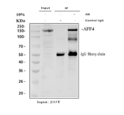 Immunoprecipitation of AFF4 protein from 500ug of human 293T whole cell lysate with 2ug of AFF4 antibody.