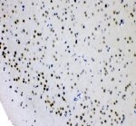 AFF4 Antibody Mouse Brain IHC. Immunohistochemical staining of FFPE mouse brain tissue using AFF4 Antibody / AF4/FMR2 Family Member 4 Antibody at 2 ug/ml. Heat-induced epitope retrieval was performed using pH8 EDTA buffer, followed by HRP-conjugated secondary antibody detection and DAB chromogen. Predominantly nuclear staining is observed throughout the brain parenchyma, consistent with the expected localization of the transcriptional regulator AFF4. This AFF4 Antibody, also called AF4/FMR2 Family Member 4 Antibody, is suitable for studies of transcription elongation, nuclear protein expression, Super Elongation Complex biology, and gene regulation.