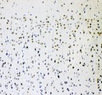 AFF4 Antibody Rat Brain IHC. Immunohistochemical staining of FFPE rat brain tissue using AFF4 Antibody / AF4/FMR2 Family Member 4 Antibody at 2 ug/ml. Heat-induced epitope retrieval was performed using pH8 EDTA buffer, followed by HRP-conjugated secondary antibody detection and DAB chromogen. Predominantly nuclear staining is observed throughout the brain parenchyma, consistent with the expected localization of the transcriptional regulator AFF4. This AFF4 Antibody, also called AF4/FMR2 Family Member 4 Antibody, is suitable for studies of transcription elongation, nuclear protein expression, Super Elongation Complex biology, and gene regulation.