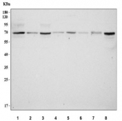 Western blot testing of 1) human HeLa, 2) human Jurkat, 3) human PC3, 4) rat brain, 5) rat heart, 6) mouse brain, 7) mouse heart and 8) mouse Neuro-2a cell lysate with ST7 antibody. Predicted molecular weight ~67 kDa.