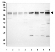 ARNTL Antibody Human, Rat and Mouse WB. Western blot analysis of ARNTL Antibody / Aryl Hydrocarbon Receptor Nuclear Translocator Like Antibody detected a major band at approximately 69 kDa, consistent with the predicted molecular weight of ARNTL. Lane 1: human HeLa; Lane 2: human HT-1080; Lane 3: human MCF7; Lane 4: human SH-SY5Y; Lane 5: rat brain; Lane 6: rat liver; Lane 7: mouse brain; Lane 8: mouse liver lysate. The membrane was incubated with ARNTL antibody followed by an HRP-conjugated secondary antibody. This ARNTL Antibody, an Aryl Hydrocarbon Receptor Nuclear Translocator Like antibody, detects endogenous ARNTL across human, rat and mouse samples for studies of circadian rhythm regulation and transcriptional control.