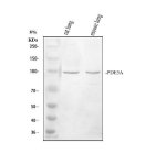 PDE5A Antibody Mouse and Rat Lung WB. Western blot analysis was performed using PDE5A Antibody at 0.5 ug/mL. Lane 1: rat lung tissue lysate; lane 2: mouse lung tissue lysate. Proteins were separated on an 8% SDS-PAGE gel, transferred to a nitrocellulose membrane, and the blot was incubated with the primary antibody overnight at 4Â°C. Bound antibody was detected using an HRP-conjugated goat anti-rabbit IgG secondary antibody and enhanced chemiluminescence. A specific immunoreactive band is detected at approximately 100 kDa in both rat and mouse lung lysates, consistent with the expected molecular weight of PDE5A. These results demonstrate that this cGMP Specific Phosphodiesterase Antibody is suitable for Western blot detection of PDE5A in rodent tissues.