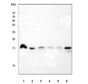 Western blot testing of 1) human T-47D, 2) human A549, 3) rat stomach, 4) rat small intestine, 5) mouse stomach and 6) mouse small intestine tissue lysate with AGR2 antibody at 0.5ug/ml. Expected molecular weight: 17-20 kDa.