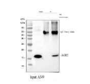 Immunoprecipitation of Anterior gradient protein 2 from 500ug of human A549 whole cell lysate with 2ug of AGR2 antibody.
