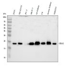 HRAS Antibody in Human, Rat and Mouse Samples WB. Western blot testing of HRAS Antibody / HRas Proto-Oncogene GTPase Antibody using lysates from 1) human 293T cells, 2) human SH-SY5Y neuroblastoma cells, 3) human PC-3 prostate cancer cells, 4) human MCF-7 breast cancer cells, 5) rat kidney, 6) rat C6 glioma cells, 7) mouse kidney and 8) mouse NIH3T3 cells. The antibody was used at 0.5 ug/ml overnight at 4oC, followed by goat anti-rabbit IgG-HRP at 1:5000 and ECL detection. A specific band is detected at approximately 18 kDa, consistent with the expected 18-21 kDa range for HRAS. This HRAS Antibody demonstrates detection of HRas proto-oncogene GTPase in human, rat and mouse samples.