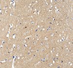 HRAS Antibody in Human Cerebral Cortex IHC. Immunohistochemistry staining of FFPE human cerebral cortex tissue with HRAS Antibody / HRas Proto-Oncogene GTPase Antibody at 2 ug/ml. Heat-induced epitope retrieval (HIER) was performed in EDTA buffer, pH 8.0, followed by blocking with 10% goat serum. The tissue was incubated with the primary antibody overnight at 4oC, followed by a peroxidase-conjugated goat anti-rabbit IgG secondary antibody for 30 min at 37oC and DAB detection. HRAS staining is observed throughout the cerebral cortex. This HRAS Antibody demonstrates detection of HRas proto-oncogene GTPase in human brain tissue.