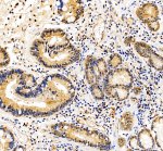 HRAS Antibody in Human Stomach IHC. Immunohistochemistry staining of FFPE human stomach tissue with HRAS Antibody / HRas Proto-Oncogene GTPase Antibody at 2 ug/ml. Heat-induced epitope retrieval (HIER) was performed in EDTA buffer, pH 8.0, followed by blocking with 10% goat serum. The tissue was incubated with the primary antibody overnight at 4oC, followed by a peroxidase-conjugated goat anti-rabbit IgG secondary antibody for 30 min at 37oC and DAB detection. HRAS staining is observed in the gastric glandular epithelium. This HRAS Antibody demonstrates detection of HRas proto-oncogene GTPase in human stomach tissue.