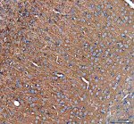 HRAS Antibody in Mouse Brain IHC. Immunohistochemistry staining of FFPE mouse brain tissue with HRAS Antibody / HRas Proto-Oncogene GTPase Antibody at 2 ug/ml. Heat-induced epitope retrieval (HIER) was performed in EDTA buffer, pH 8.0, followed by blocking with 10% goat serum. The tissue was incubated with the primary antibody overnight at 4oC, followed by a peroxidase-conjugated goat anti-rabbit IgG secondary antibody for 30 min at 37oC and DAB detection. HRAS staining is observed throughout the brain tissue, including neuronal populations. This HRAS Antibody demonstrates detection of HRas proto-oncogene GTPase in mouse brain tissue.