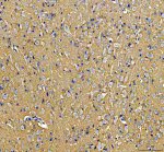 HRAS Antibody in Rat Brain IHC. Immunohistochemistry staining of FFPE rat brain tissue with HRAS Antibody / HRas Proto-Oncogene GTPase Antibody at 2 ug/ml. Heat-induced epitope retrieval (HIER) was performed in EDTA buffer, pH 8.0, followed by blocking with 10% goat serum. The tissue was incubated with the primary antibody overnight at 4oC, followed by a peroxidase-conjugated goat anti-rabbit IgG secondary antibody for 30 min at 37oC and DAB detection. HRAS staining is observed throughout the brain tissue, including neuronal populations. This HRAS Antibody demonstrates detection of HRas proto-oncogene GTPase in rat brain tissue.