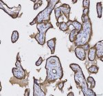 Cytokeratin 8 Antibody Human Placenta IHC. Immunohistochemical staining of FFPE human placenta tissue using Cytokeratin 8 Antibody / KRT8 Antibody at 2 ug/ml. Heat-induced epitope retrieval was performed using pH8 EDTA buffer, followed by HRP-conjugated secondary antibody detection and DAB chromogen. Strong membranous and cytoplasmic staining is observed in placental trophoblasts, consistent with the expected localization of Cytokeratin 8 in epithelial-derived cells. This Cytokeratin 8 Antibody, also called KRT8 Antibody, is suitable for studies of epithelial differentiation, intermediate filament organization, placental biology, and Cytokeratin 8 protein localization.