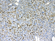 Cytokeratin 8 Antibody Mouse Liver IHC. Immunohistochemical staining of FFPE mouse liver tissue using Cytokeratin 8 Antibody at 1 Âµg/ml demonstrates distinct membranous and cytoplasmic HRP-DAB brown staining within hepatocytes throughout the hepatic parenchyma. The staining pattern is consistent with expression of Cytokeratin 8 (CK8/KRT8), a type II intermediate filament protein that contributes to epithelial cytoskeletal organization and structural integrity. Cytokeratin 8 immunoreactivity highlights hepatocellular morphology and cell boundaries, supporting its utility as a marker of epithelial lineage and hepatic tissue architecture. Required HIER: steam tissue sections in pH 6 citrate buffer for 20 minutes and allow to cool prior to testing.