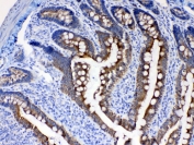 Cytokeratin 8 Antibody Rat Intestine IHC. Immunohistochemical staining of FFPE rat intestine tissue using Cytokeratin 8 Antibody at 1 Âµg/ml demonstrates strong membranous and cytoplasmic HRP-DAB brown staining within intestinal epithelial cells lining glandular and mucosal structures. The staining pattern is consistent with expression of Cytokeratin 8 (CK8/KRT8), a type II intermediate filament protein widely expressed in simple epithelial tissues where it contributes to cytoskeletal organization and epithelial integrity. Cytokeratin 8 immunoreactivity highlights intestinal epithelial architecture and cellular organization while surrounding stromal elements exhibit minimal staining. Required HIER: steam tissue sections in pH 6 citrate buffer for 20 minutes and allow to cool prior to testing.