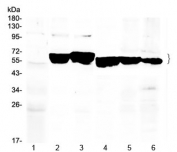 Cytokeratin 8 Antibody Multi-Species Western Blot. Western blot analysis of rat liver (lane 1), mouse ovary (lane 2), mouse liver (lane 3), human MCF7 (lane 4), human A549 (lane 5), and human HeLa (lane 6) lysates using Cytokeratin 8 Antibody at 0.5 Âµg/ml demonstrates a prominent band at approximately 54-56 kDa, consistent with the predicted molecular weight of Cytokeratin 8 (CK8/KRT8). Cytokeratin 8 is a type II intermediate filament protein widely expressed in simple epithelial tissues and epithelial-derived cell lines, where it contributes to cytoskeletal organization, epithelial integrity, and cellular stress-response pathways. Detection of the expected molecular weight band across rodent tissues and human cell lines supports cross-species reactivity and the suitability of this antibody for western blot applications.