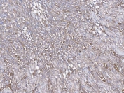 IHC staining of FFPE mouse liver tissue with Annexin IV antibody. HIER: boil tissue sections in pH8 EDTA for 20 min and allow to cool before testing.