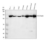 Vinculin Antibody Human, Rat and Mouse WB. Western blot analysis demonstrates detection of Vinculin in human, rat, and mouse samples. Lane 1: human PC-3 whole cell lysate, Lane 2: human U251 whole cell lysate, Lane 3: human A549 whole cell lysate, Lane 4: rat heart tissue lysate, Lane 5: rat lung tissue lysate, Lane 6: mouse heart tissue lysate, Lane 7: mouse lung tissue lysate. A prominent band is detected at approximately 124 kDa, consistent with the expected molecular weight of Vinculin. This Vinculin Antibody for Western Blot, also called VCL WB Antibody, provides reliable detection of endogenous VCL across multiple species, making it well suited for comparative immunoblot analysis of focal adhesion biology, cytoskeletal organization, and cell adhesion signaling.