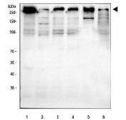 BRCA1 Antibody Human Mouse Rat WB. Western blot testing of 1) human HeLa, 2) human MCF7, 3) human T-47D, 4) human Caco-2, 5) rat C6 and 7) mouse Neuro-2a cell lysate with BRCA1 antibody. Predicted molecular weight ~207 kDa, commonly observed at 207-220 kDa.