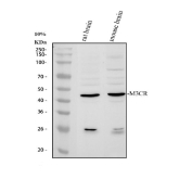Western blot analysis of MC3 Receptor/MC3R Antibody in rat and mouse brain tissue. Rat brain and mouse brain tissue lysates were resolved by SDS-PAGE and transferred to a nitrocellulose membrane, followed by incubation with MC3 Receptor/MC3R Antibody and HRP-conjugated secondary antibody. A predominant band is observed at approximately 42 kDa in both samples relative to the predicted molecular weight of MC3R at approximately 36 kDa, consistent with reported anomalous migration of GPCR proteins on SDS-PAGE, while lower molecular weight bands may represent proteolytic fragments or partially processed receptor species.