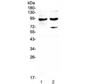 STAT1 Antibody Thymus WB. Western blot analysis of rat thymus and mouse thymus tissue lysates using STAT1 antibody demonstrates prominent immunoreactive bands at approximately 91 and 84 kDa, corresponding to the alpha and beta isoforms of Signal Transducer and Activator of Transcription 1 (STAT1). STAT1 is a central transcription factor within the JAK-STAT signaling pathway that mediates cellular responses to interferons, cytokines, and immune regulatory signals. The strong expression observed in thymic tissues is consistent with the important role of STAT1 in immune system development, cytokine signaling, and transcriptional regulation within lymphoid organs. Western blot was performed using 0.5 ug/ml primary antibody. Predicted molecular weights: ~91 kDa (STAT1 alpha) and ~84 kDa (STAT1 beta).