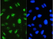 STAT1 Antibody U-2 OS IF/ICC. Immunofluorescent staining of FFPE human U-2 OS cells using STAT1 antibody demonstrates prominent green fluorescence within both the nucleus and cytoplasm, consistent with the known subcellular localization and signaling function of Signal Transducer and Activator of Transcription 1 (STAT1). STAT1 is a key transcription factor within the JAK-STAT signaling pathway that undergoes activation-dependent nuclear translocation to regulate expression of interferon-responsive and cytokine-regulated genes. The observed staining pattern is consistent with the role of STAT1 in transcriptional regulation, immune signaling, and cellular responses to extracellular stimuli. Nuclei are visualized with DAPI nuclear stain (blue). HIER: steam section in pH6 citrate buffer for 20 min and allow to cool prior to testing.