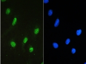 STAT1 Antibody U-2 OS Cell IF. Immunofluorescent staining of FFPE human U-2 OS cells using STAT1 antibody demonstrates strong green fluorescence predominantly within the nucleus, consistent with the role of Signal Transducer and Activator of Transcription 1 (STAT1) as a transcription factor that translocates to the nucleus following activation. STAT1 is a central mediator of JAK-STAT signaling and regulates expression of genes involved in interferon responses, cytokine signaling, immune regulation, and cellular adaptation to extracellular stimuli. The observed nuclear staining pattern is consistent with transcriptionally active STAT1 participating in signal-dependent gene regulation. Nuclei are visualized with DAPI nuclear stain (blue). HIER: steam section in pH6 citrate buffer for 20 min and allow to cool prior to testing.