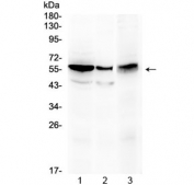 ALDH1A3 Antibody Human Mouse Rat WB. Western blot analysis of 1) rat kidney, 2) mouse stomach, and 3) human HepG2 lysates using ALDH1A3 antibody demonstrates a prominent immunoreactive band at approximately 56 kDa, consistent with the predicted molecular weight of Aldehyde Dehydrogenase 1 Family Member A3 (ALDH1A3). Also known as retinaldehyde dehydrogenase 3 (RALDH3), ALDH1A3 is an NAD-dependent enzyme responsible for catalyzing the conversion of retinaldehyde to retinoic acid, a critical signaling molecule involved in cellular differentiation and developmental regulation. The observed expression across rat, mouse, and human samples is consistent with the conserved role of ALDH1A3 in retinoid metabolism, tissue homeostasis, and maintenance of cellular identity. Western blot was performed using 0.5 ug/ml primary antibody. Predicted molecular weight: ~56 kDa.