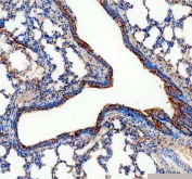 ALDH1A3 Antibody Rat Lung IHC. Immunohistochemistry staining of FFPE rat lung tissue using ALDH1A3 antibody with HRP-secondary and DAB chromogen demonstrates prominent cytoplasmic staining of bronchiolar and airway-associated epithelial cells, consistent with expression of Aldehyde Dehydrogenase 1 Family Member A3 (ALDH1A3). Also known as retinaldehyde dehydrogenase 3 (RALDH3), ALDH1A3 is an NAD-dependent enzyme that catalyzes the conversion of retinaldehyde to retinoic acid, thereby regulating retinoid metabolism and differentiation-associated signaling pathways. The observed staining pattern is consistent with the role of ALDH1A3 in epithelial homeostasis, tissue maintenance, and cellular differentiation within the respiratory tract. These findings support the utility of ALDH1A3 antibody for studies of retinoic acid biology, developmental metabolism, and tissue-specific regulation. HIER: boil tissue sections in pH 8 EDTA for 20 min and allow to cool before testing.
