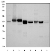 ALDH1A3 Antibody Multi-Species WB. Western blot analysis of 1) human HepG2, 2) human U-87 MG, 3) human PC-3, 4) rat liver, 5) rat kidney, 6) rat C6, 7) mouse liver, and 8) mouse kidney tissue lysates using ALDH1A3 antibody demonstrates a prominent immunoreactive band at approximately 56 kDa, consistent with the predicted molecular weight of Aldehyde Dehydrogenase 1 Family Member A3 (ALDH1A3). Also known as retinaldehyde dehydrogenase 3 (RALDH3), ALDH1A3 is an NAD-dependent enzyme responsible for catalyzing the conversion of retinaldehyde to retinoic acid, thereby regulating retinoid metabolism and differentiation-associated signaling pathways. The broad expression observed across human, rat, and mouse tissues is consistent with the conserved role of ALDH1A3 in tissue homeostasis, cellular differentiation, and maintenance of retinoic acid-dependent biologic processes. Western blot was performed using 0.5 ug/ml primary antibody. Predicted molecular weight: ~56 kDa.