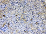 ALDH1A3 Antibody Mouse Kidney IHC. Immunohistochemistry staining of FFPE mouse kidney tissue using ALDH1A3 antibody demonstrates weak to moderate cytoplasmic staining within renal tubular epithelial cells, consistent with expression of Aldehyde Dehydrogenase 1 Family Member A3 (ALDH1A3). Also known as retinaldehyde dehydrogenase 3 (RALDH3), ALDH1A3 is an NAD-dependent enzyme that catalyzes the conversion of retinaldehyde to retinoic acid, thereby contributing to retinoid metabolism and regulation of differentiation-associated signaling pathways. The observed staining pattern is consistent with the role of ALDH1A3 in tissue homeostasis, cellular metabolism, and maintenance of specialized epithelial functions. These findings support the utility of ALDH1A3 antibody for studies of retinoic acid biology, tissue differentiation, and developmental metabolism. Required HIER: steam section in pH6 citrate buffer for 20 min and allow to cool prior to testing.
