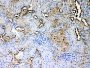 ALDH1A3 Antibody Rat Kidney IHC. Immunohistochemistry staining of FFPE rat kidney tissue using ALDH1A3 antibody demonstrates cytoplasmic staining within renal tubular epithelial structures, consistent with expression of Aldehyde Dehydrogenase 1 Family Member A3 (ALDH1A3). Also known as retinaldehyde dehydrogenase 3 (RALDH3), ALDH1A3 is an NAD-dependent enzyme responsible for the synthesis of retinoic acid from retinaldehyde and serves as an important regulator of retinoid metabolism and differentiation-associated signaling pathways. The observed staining pattern is consistent with the role of ALDH1A3 in maintaining epithelial homeostasis, cellular metabolism, and tissue-specific functions within the kidney. These findings support the utility of ALDH1A3 antibody for studies of retinoic acid biology, developmental metabolism, and tissue differentiation. Required HIER: steam section in pH6 citrate buffer for 20 min and allow to cool prior to testing.