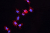 ALDH1A3 Antibody A431 IF. Immunofluorescent staining of human A431 cells using ALDH1A3 antibody demonstrates prominent cytoplasmic red fluorescence, consistent with expression of Aldehyde Dehydrogenase 1 Family Member A3 (ALDH1A3). Also known as retinaldehyde dehydrogenase 3 (RALDH3), ALDH1A3 is an NAD-dependent enzyme that catalyzes the conversion of retinaldehyde to retinoic acid, thereby regulating retinoid metabolism and differentiation-associated signaling pathways. The observed cytoplasmic localization is consistent with the enzymatic function of ALDH1A3 and supports the utility of this antibody for studies of retinoic acid synthesis, stem cell biology, tissue differentiation, and cancer-associated cellular plasticity. Nuclei are visualized with DAPI nuclear stain (blue).