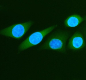 ALDH1A3 Antibody SiHa IF. Immunofluorescent staining of FFPE human SiHa cells using ALDH1A3 antibody demonstrates prominent cytoplasmic green fluorescence, consistent with expression of Aldehyde Dehydrogenase 1 Family Member A3 (ALDH1A3). Also known as retinaldehyde dehydrogenase 3 (RALDH3), ALDH1A3 is an NAD-dependent enzyme responsible for the conversion of retinaldehyde to retinoic acid and plays important roles in retinoid metabolism, cellular differentiation, and maintenance of tissue homeostasis. The observed cytoplasmic localization is consistent with the enzymatic function of ALDH1A3 and supports the utility of this antibody for studies of retinoic acid signaling, stem cell biology, developmental metabolism, and cancer-associated cellular plasticity. Nuclei are visualized with DAPI nuclear stain (blue). HIER: steam section in pH6 citrate buffer for 20 min.