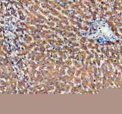 ALDH1A3 Antibody Human Liver IHC. Immunohistochemistry staining of FFPE human liver tissue using ALDH1A3 antibody with HRP-secondary and DAB chromogen demonstrates strong diffuse cytoplasmic staining throughout hepatocyte populations, consistent with expression of Aldehyde Dehydrogenase 1 Family Member A3 (ALDH1A3). Also known as retinaldehyde dehydrogenase 3 (RALDH3), ALDH1A3 is an NAD-dependent enzyme responsible for the conversion of retinaldehyde to retinoic acid, thereby regulating retinoid metabolism and differentiation-associated signaling pathways. The observed staining pattern is consistent with the metabolic and homeostatic functions of ALDH1A3 in hepatic tissue and supports the utility of this antibody for studies of retinoic acid biology, tissue differentiation, and cancer-associated cellular plasticity. HIER: boil tissue sections in pH 8 EDTA for 20 min and allow to cool before testing.