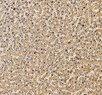 LEPR Polyclonal Antibody by IHC in human liver. Immunohistochemistry of FFPE human liver tissue using LEPR Polyclonal Antibody at 2 ug/ml. Brown DAB staining is observed throughout the hepatocyte population, predominantly in the cytoplasm with a granular distribution and some peripheral membrane-associated staining. Nuclei are counterstained blue with hematoxylin. Heat-induced epitope retrieval was performed using EDTA buffer, pH 8.0, followed by overnight primary antibody incubation at 4oC. This Leptin Receptor Rabbit Antibody recognizes LEPR, a cytokine receptor involved in leptin-dependent signaling and metabolic homeostasis.