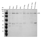 LEPR Polyclonal Antibody by WB in human, rat, and mouse samples. Western blot analysis using LEPR Polyclonal Antibody at 0.5 ug/ml. Lanes 1-4: human K562, HeLa, HepG2, and HEL cell lysates; lanes 5-6: rat lung and kidney; lanes 7-8: mouse lung and kidney. Each lane contained 30 ug protein separated by 8% SDS-PAGE under reducing conditions. A distinct band is detected at approximately 150 kDa across all eight samples, compared with the predicted LEPR molecular weight of 132.5 kDa. The higher apparent molecular weight may reflect receptor glycosylation. Additional lower-molecular-weight bands may reflect alternative LEPR isoforms, protein fragments, or nonspecific immunoreactivity. This Leptin Receptor Rabbit Antibody recognizes a cytokine receptor involved in metabolic regulation and JAK/STAT signaling.