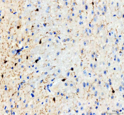AIF1 Antibody Mouse Brain IHC. Immunohistochemistry analysis of paraffin-embedded mouse brain tissue using AIF1 Antibody demonstrates HRP-DAB brown cytoplasmic staining in scattered microglial cells within the neural parenchyma, showing characteristic ramified morphology with fine branching processes consistent with AIF1 / IBA1 expression as a microglia marker involved in neuroimmune surveillance and inflammatory activation, while surrounding neurons and other glial cells remain largely negative; nuclei are counterstained blue. HIER: heat-mediated antigen retrieval in EDTA buffer (pH 8.0).