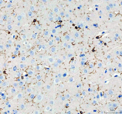 AIF1 Antibody Pig Brain IHC. Immunohistochemistry analysis of paraffin-embedded pig brain tissue using AIF1 Antibody demonstrates HRP-DAB brown cytoplasmic staining in scattered microglial cells throughout the neural parenchyma, displaying characteristic ramified morphology with fine branching processes consistent with AIF1 / IBA1 expression as a microglia marker involved in neuroimmune surveillance and inflammatory response, while surrounding neuronal cells remain largely negative; nuclei are counterstained blue. HIER: heat-mediated antigen retrieval in EDTA buffer (pH 8.0).