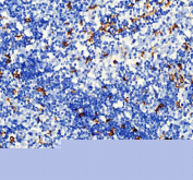 AIF1 Antibody Spleen IHC. IBA1/AIF-1 was detected in paraffin-embedded sections of human spleen tissue. Heat-mediated antigen retrieval was performed in EDTA buffer (pH 8.0). The tissue sections were blocked with 10% goat serum and incubated with rabbit anti-IBA1/AIF-1 antibody overnight at 4Â°C. Peroxidase-conjugated goat anti-rabbit IgG was used as secondary antibody and incubated for 30 minutes at 37Â°C. The tissue sections were developed using an HRP-conjugated detection system with DAB as the chromogen.