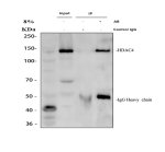 HDAC4 Antibody by IP in human Jurkat cells. Immunoprecipitation of HDAC4 from Jurkat whole-cell lysate using HDAC4 Antibody. Lane 1: Jurkat lysate input (30 ug); lane 2: immunoprecipitation with rabbit control IgG; lane 3: immunoprecipitation using 2 ug antibody and 500 ug Jurkat lysate. Western blot detection was performed using the same antibody at 0.5 ug/ml. A prominent HDAC4 band is observed at approximately 140 kDa in the input and antibody IP lanes, but not in the IgG control, demonstrating successful enrichment. The observed molecular weight exceeds the predicted 119 kDa, potentially reflecting post-translational modifications, including phosphorylation. This Histone Deacetylase 4 Antibody recognizes a class IIa histone deacetylase involved in transcriptional regulation.