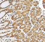 EIF3E Antibody Human Stomach IHC. Immunohistochemistry was performed on FFPE human stomach tissue using EIF3E Antibody. Heat-induced epitope retrieval was performed in pH 8 EDTA buffer prior to incubation with the primary antibody at 2 ug/ml. Bound antibody was visualized using an HRP-conjugated goat anti-rabbit IgG secondary antibody with DAB chromogen. Strong cytoplasmic staining is observed in gastric glandular epithelial cells, while the adjacent surface epithelium shows comparatively weaker immunoreactivity, consistent with the widespread expression of EIF3E in metabolically active secretory cells. These results demonstrate that this Translation Initiation Factor Antibody is suitable for immunohistochemical detection of EIF3E in formalin-fixed, paraffin-embedded human stomach tissue.