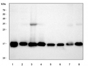 Cyclophilin A Antibody Human Mouse Rat WB. Western blot analysis of 1) human THP-1, 2) human HepG2, 3) human MOLT4, 4) human Daudi, 5) rat lung, 6) rat brain, 7) mouse lung, and 8) mouse brain tissue lysates using Cyclophilin A Antibody / Protein Folding Chaperone Antibody. A strong immunoreactive band is detected at approximately 18 kDa across all tested human, rat, and mouse samples, consistent with the expected molecular weight of Cyclophilin A (PPIA). Cyclophilin A is a highly conserved peptidyl-prolyl cis-trans isomerase that functions as a molecular chaperone involved in protein folding, intracellular signaling, and cellular stress responses. The broad expression observed across multiple tissues and species is consistent with the ubiquitous cellular distribution of Cyclophilin A and supports the utility of this antibody for cross-species western blot applications. Predicted molecular weight: ~18 kDa. Observed molecular weight: ~18 kDa. A faint higher molecular weight band detected in some human samples may represent post-translationally modified Cyclophilin A, protein complexes, or minor nonspecific reactivity.