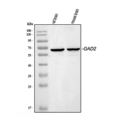 GAD65 Antibody for WB Mouse Rat Brain. Western blot analysis of GAD65 Antibody for WB in rat and mouse brain lysates. Lane 1: rat brain lysate, Lane 2: mouse brain lysate. A distinct band is detected at approximately 65 kDa in both lanes, consistent with the predicted molecular weight of Glutamate decarboxylase 2 (GAD65).