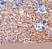 IHC staining of FFPE mouse kidney tissue with Bax antibody, HRP-labeled secondary and DAB substrate. HIER: boil tissue sections in pH8 EDTA for 20 min and allow to cool before testing.