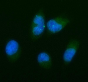 Bcl-XL Antibody IF. Immunofluorescent staining of FFPE human TPC-1 cells using Bcl-XL Antibody / Anti-Apoptotic Protein Antibody demonstrates diffuse cytoplasmic green fluorescence consistent with expression of Bcl-XL, the major anti-apoptotic protein encoded by the BCL2L1 gene. The staining pattern is compatible with the known intracellular localization of Bcl-XL, which functions primarily at mitochondrial and intracellular membrane compartments to suppress apoptosis and promote cellular survival. Bcl-XL plays a critical role in regulating mitochondrial integrity, inhibiting pro-apoptotic signaling pathways, and maintaining resistance to programmed cell death. Nuclei are counterstained with DAPI (blue). HIER was performed by steaming sections in pH 6 citrate buffer for 20 minutes prior to immunofluorescent staining.