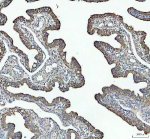 HFE Antibody Human Fallopian Tube IHC. Immunohistochemical analysis of FFPE human fallopian tube tissue following heat-induced epitope retrieval in pH8 EDTA buffer. Tissue sections were incubated with HFE Antibody at 2 ug/ml overnight, followed by an HRP-conjugated secondary antibody and DAB chromogen for visualization. Moderate membranous and cytoplasmic staining is observed in the epithelial cells lining the mucosal folds, consistent with the localization of HFE as a membrane-associated regulator of iron homeostasis. This staining pattern demonstrates that this HFE Antibody, a Hereditary Hemochromatosis Protein Antibody, is suitable for detecting endogenous HFE expression in human FFPE tissue by immunohistochemistry.