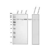 Western blot testing of 1) human HeLa, 2) human 293T, 3) human K562, 4) mouse brain and 5) mouse heart tissue lysate with NARG1 antibody at 0.5ug/ml. Predicted molecular weight ~101 kDa.