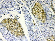 HSP22 Antibody Rat Pancreas IHC. Immunohistochemistry staining of FFPE rat pancreas tissue with HSP22 Antibody at 1 ug/ml. HIER was performed by steaming tissue sections in pH 6 citrate buffer for 20 minutes prior to staining. The tissue section was incubated with HSP22 antibody, followed by HRP-conjugated secondary antibody and DAB chromogen detection. HSP22 Antibody / Small Heat Shock Protein Antibody demonstrates strong pancreatic islet staining consistent with HSPB8 expression and supports studies of molecular chaperone activity, protein homeostasis and cellular stress response regulation pathways.