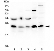 HSP22 Antibody Muscle and HeLa Cell WB. Western blot testing of rat skeletal muscle, rat heart, mouse skeletal muscle, mouse heart and human HeLa lysates with HSP22 Antibody at 0.5 ug/ml. Lane 1: rat skeletal muscle; Lane 2: rat heart; Lane 3: mouse skeletal muscle; Lane 4: mouse heart; Lane 5: human HeLa. HSP22 was detected at approximately 22-27 kDa, consistent with the expected molecular weight of HSPB8. HSP22 Antibody / Small Heat Shock Protein Antibody supports studies of molecular chaperone activity, protein quality control and cellular stress response pathways.