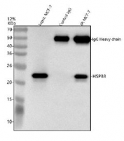 HSP22 Antibody MCF7 Cell IP. Immunoprecipitation of HSP22 from human MCF7 whole cell lysate using HSP22 Antibody. MCF7 lysate input and immunoprecipitated samples were analyzed by Western blot, with rabbit control IgG included as a negative control. HSP22 antibody was used at 2 ug for immunoprecipitation, and a specific band was detected at approximately 22-27 kDa, consistent with the expected molecular weight of HSPB8. HSP22 Antibody / Small Heat Shock Protein Antibody supports protein interaction studies and analysis of molecular chaperone activity, protein quality control and cellular stress response pathways.