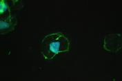 Beta-Catenin Antibody A431 Cell IF. Immunofluorescence analysis of FFPE human A431 cells using Beta-Catenin antibody shows distinct membranous green fluorescence outlining cell borders, consistent with CTNNB1 / Catenin beta-1 localization at adherens junctions, with minimal cytoplasmic signal. DAPI nuclear stain (blue) highlights nuclei, providing contrast to the peripheral staining pattern. HIER: steam FFPE sections in pH 6 citrate buffer for 20 min and allow to cool prior to testing.
