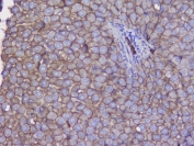 Beta-Catenin Antibody Mouse Liver Tissue IHC. Immunohistochemistry analysis of FFPE mouse liver tissue using Beta-Catenin antibody shows prominent membranous staining outlining hepatocyte borders, consistent with CTNNB1 / Catenin beta-1 localization at adherens junctions, with mild cytoplasmic signal in hepatocytes. Hepatic architecture is well preserved, and non-parenchymal regions display comparatively lower staining intensity. Hematoxylin counterstain provides nuclear contrast and structural detail. HIER: steam FFPE sections in pH 6 citrate buffer for 20 min and allow to cool prior to testing.
